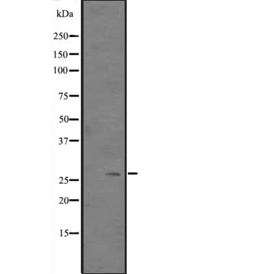 CITED2 Antibody