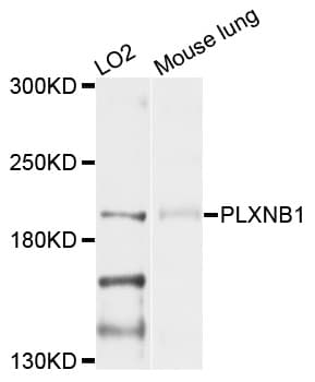 IHC-plus™ PLXNB1 / Plexin-B1 Antibody