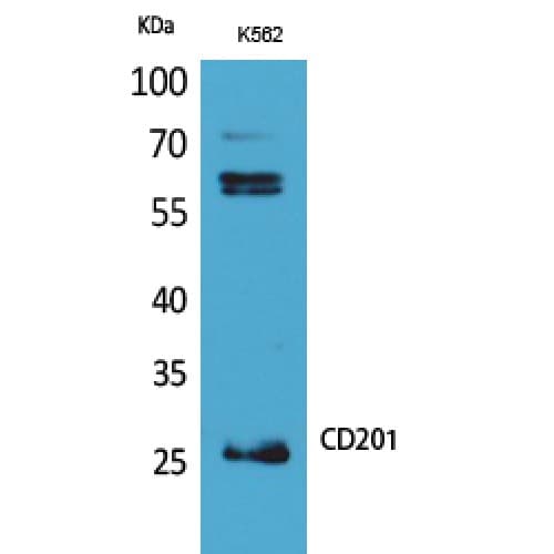 Polyclonal Rabbit anti-Human PROCR / EPCR Antibody (141-190 aa, Internal, WB)
