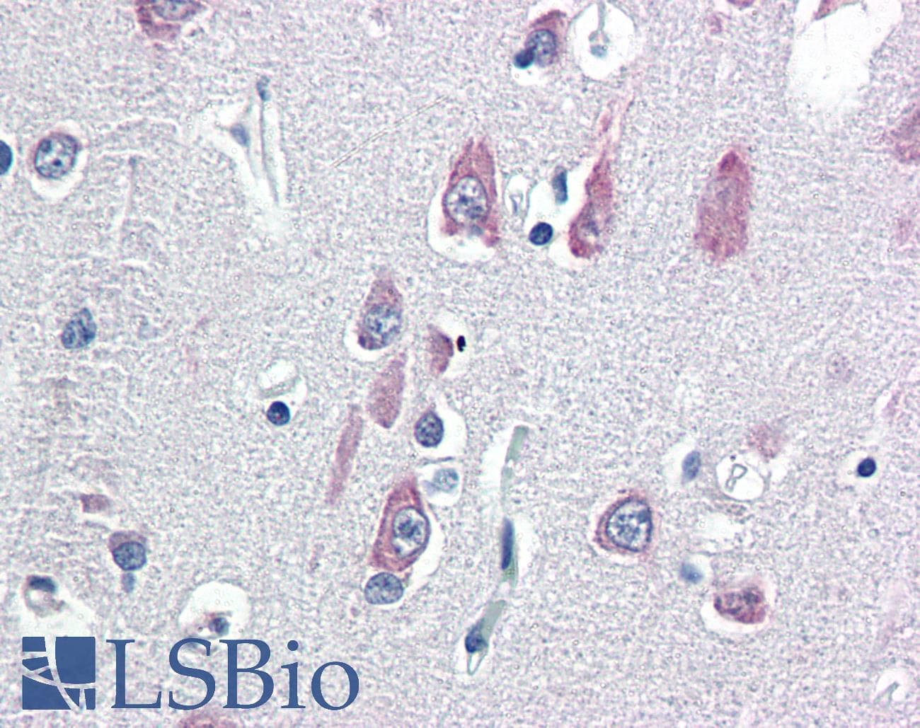 IHC-plus™ VPS25 Antibody (N-Terminus)