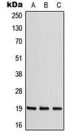 CNBP / ZNF9 Antibody (Internal)