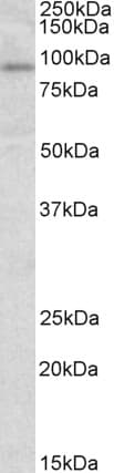 IHC-plus™ STAT3 Antibody (Internal Region)
