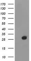 Thymidylate Kinase Antibody (clone OTI1E6)