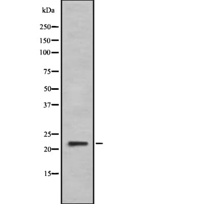 IFNA6 / Interferon Alpha 6 Antibody
