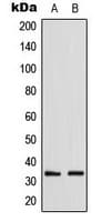 GDF15 Antibody (Internal)