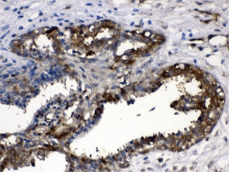LDHA / LDH1 Antibody
