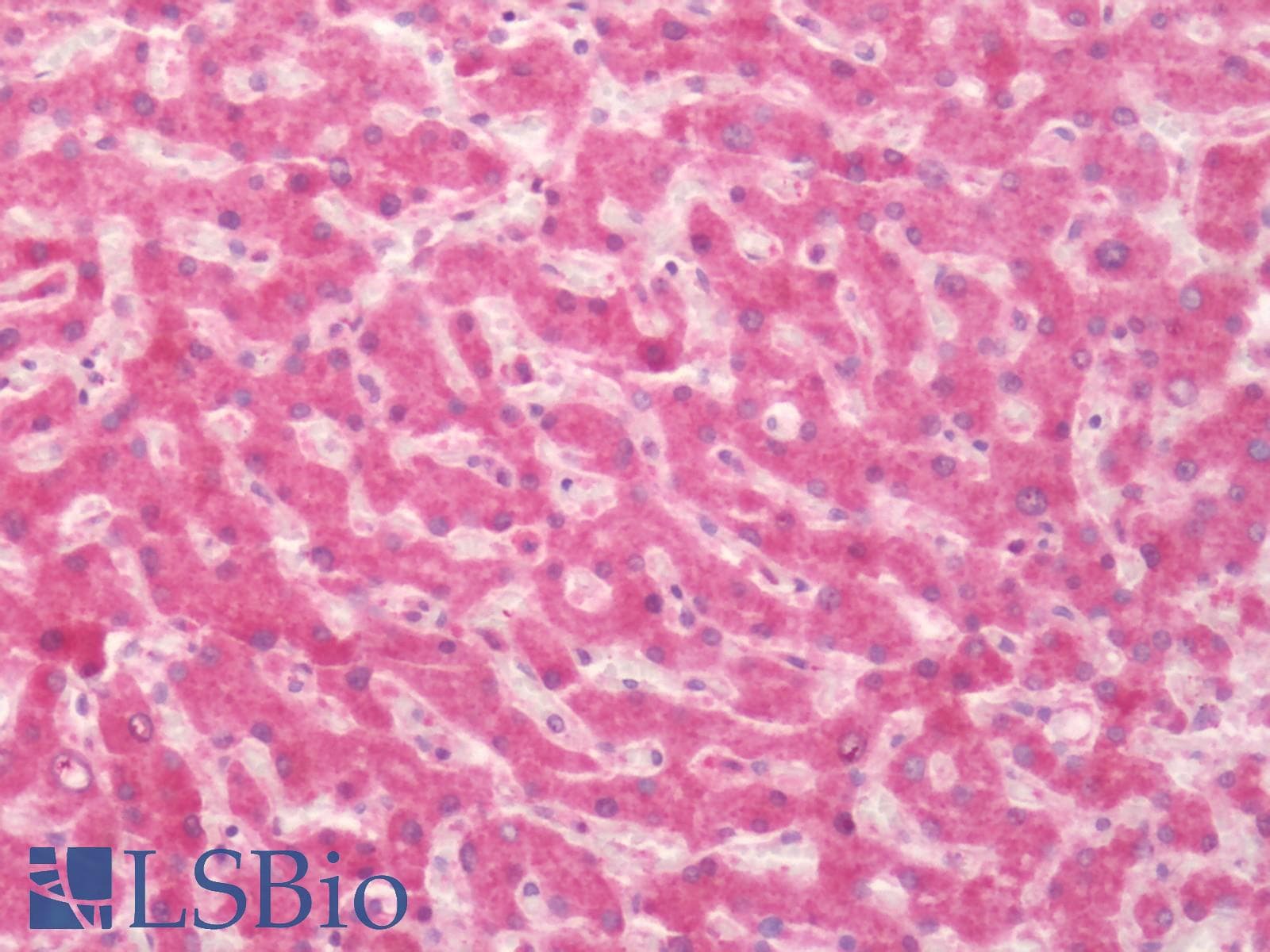IHC-plus™ Polyclonal Rabbit anti-Human FAP Alpha Antibody (Extracellular Domain, IHC)
