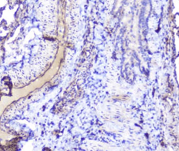 INPPL1 / SHIP2 Antibody