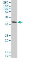 EVX1 Antibody (clone 3F4)