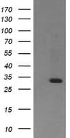 RARRES1 Antibody (clone OTI1A6)