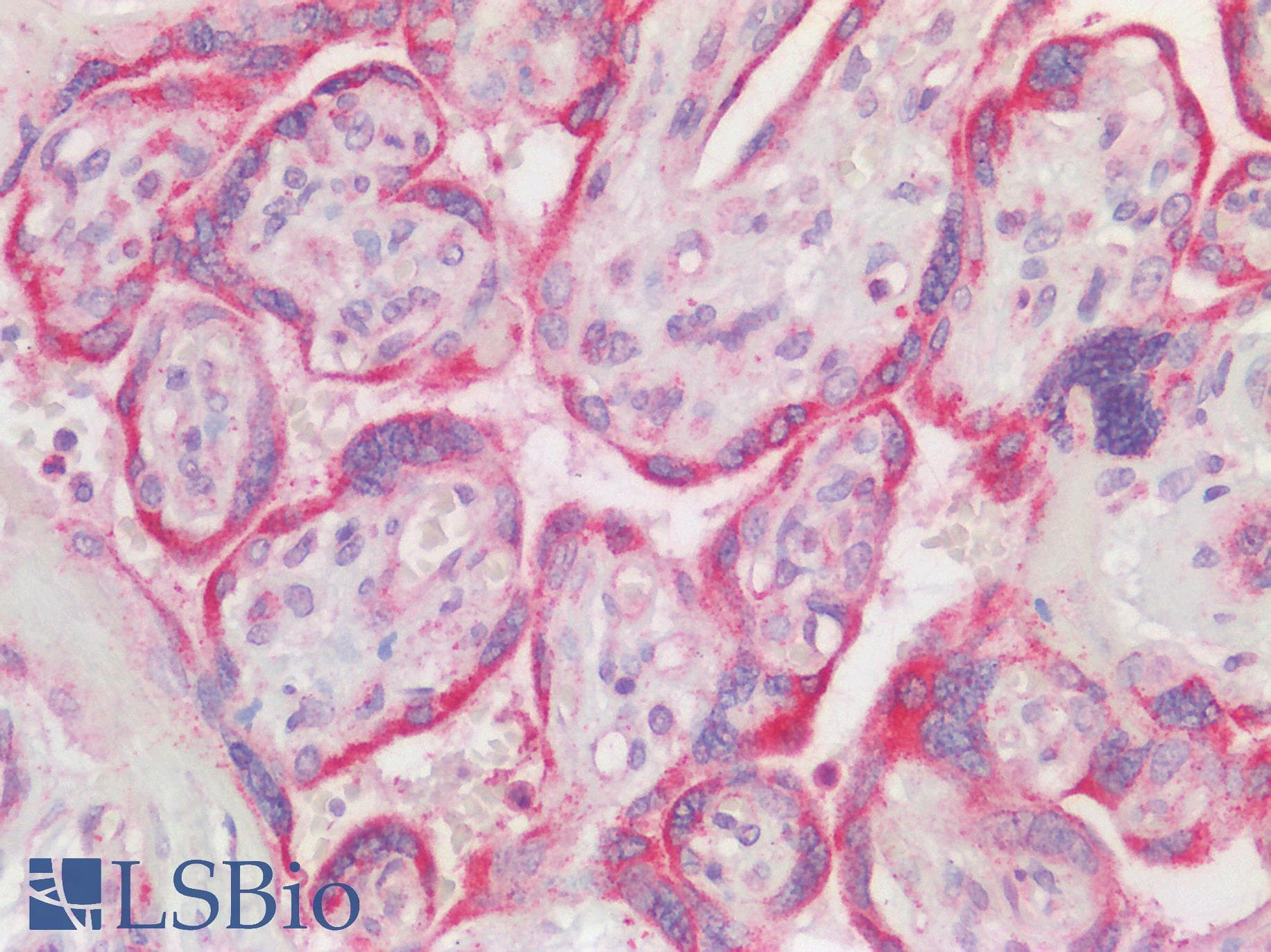 GCS1 / MOGS Antibody (aa144-193)