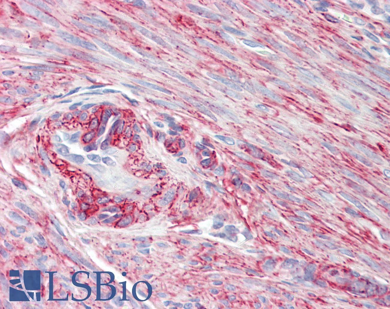 IHC-plus™ PRKCDBP / CAVIN3 Antibody (aa179-190)