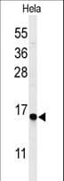 Polyclonal Rabbit anti-Human GABARAPL1 / ATG8 Antibody (IHC, WB)