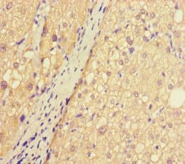Polyclonal Rabbit anti-Human ASB10 Antibody