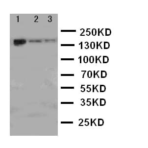 ERBB4 / HER4 Antibody (aa35-51)