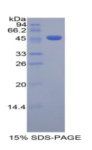 Human EPOR / EPO Receptor Protein (Recombinant His-GST)