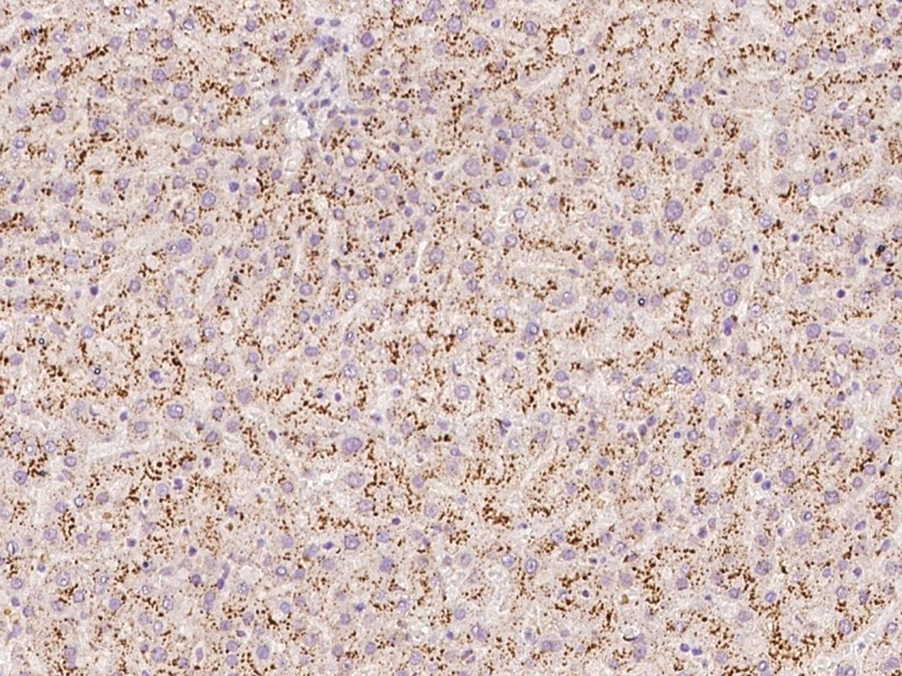 Polyclonal Rabbit anti-Human TMEM192 Antibody (IHC, IF, WB)