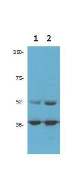 IHC-plus™ CDK9 Antibody (N-Terminus and C-Terminus)