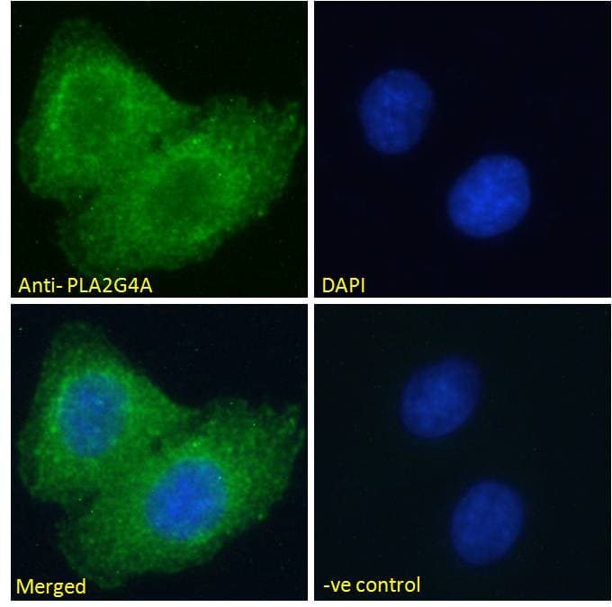 IHC-plus™ Polyclonal Goat anti-Human PLA2G4A Antibody (aa153-166, IHC, IF, WB)