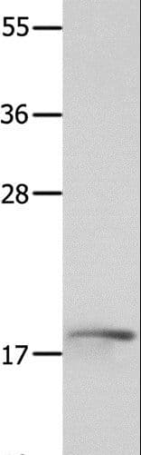 NME3 Antibody