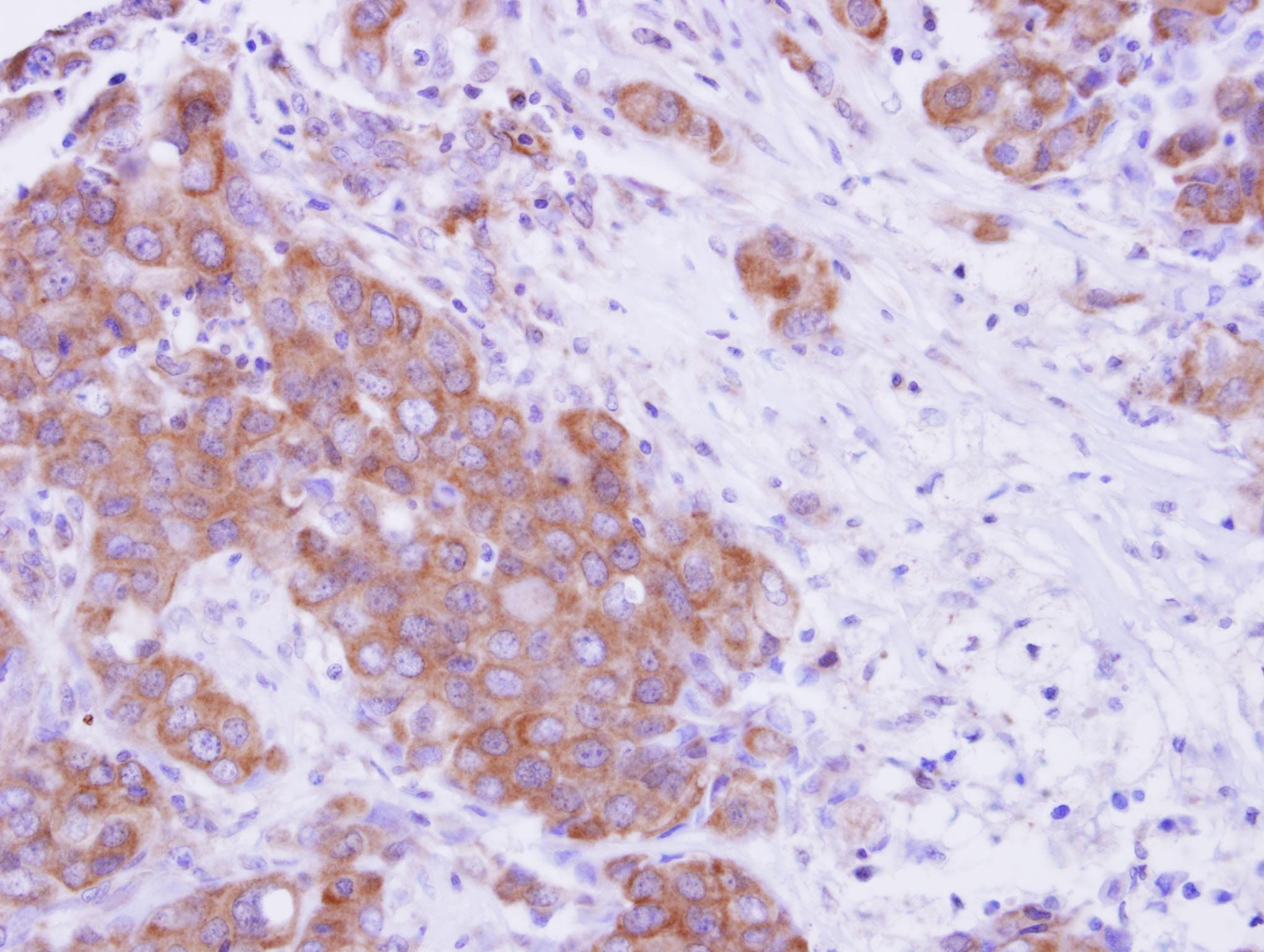 Polyclonal Rabbit anti-Human MPP3 Antibody (aa270-585, IHC, WB)