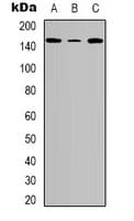 Polyclonal Rabbit anti-Human TNS2 / TENC1 Antibody (phospho-Tyr483, WB)