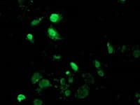 MAGEB18 Antibody (clone OTI6A5)
