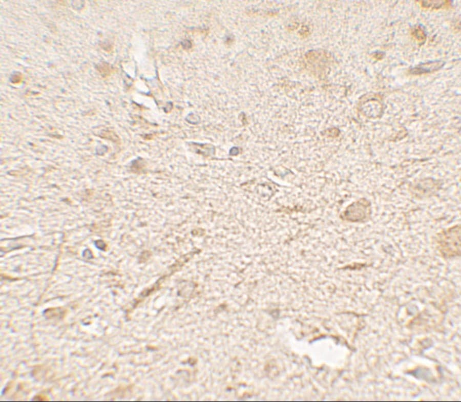 LAMTOR3 / MP1 Antibody