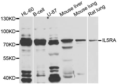 IL5RA / CD125 Antibody