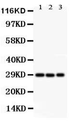 KCNIP3 / Dream / Calsenilin Antibody (aa1-16)