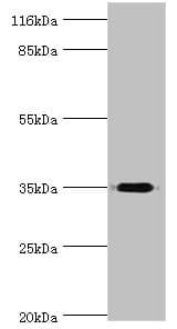 Polyclonal Rabbit anti-Human DIMT1L Antibody (aa1-313, IHC, WB)