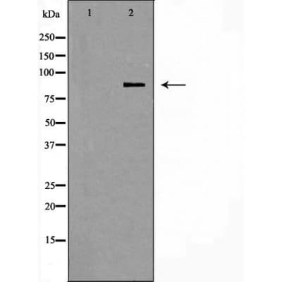 PIK3R1 / p85 Alpha Antibody