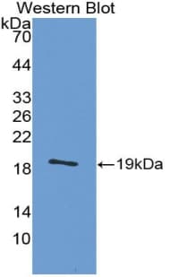 CALCB Antibody (aa1-127, Cy3)