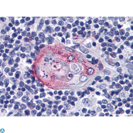 AKT2 Antibody