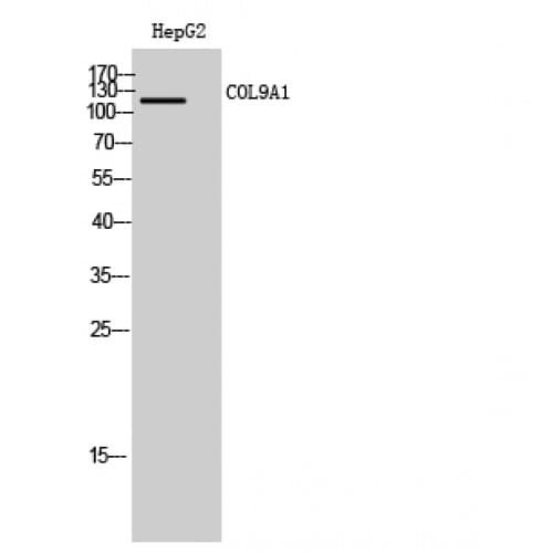 COL9A1 / Collagen IX Antibody (390-470 aa, Internal)