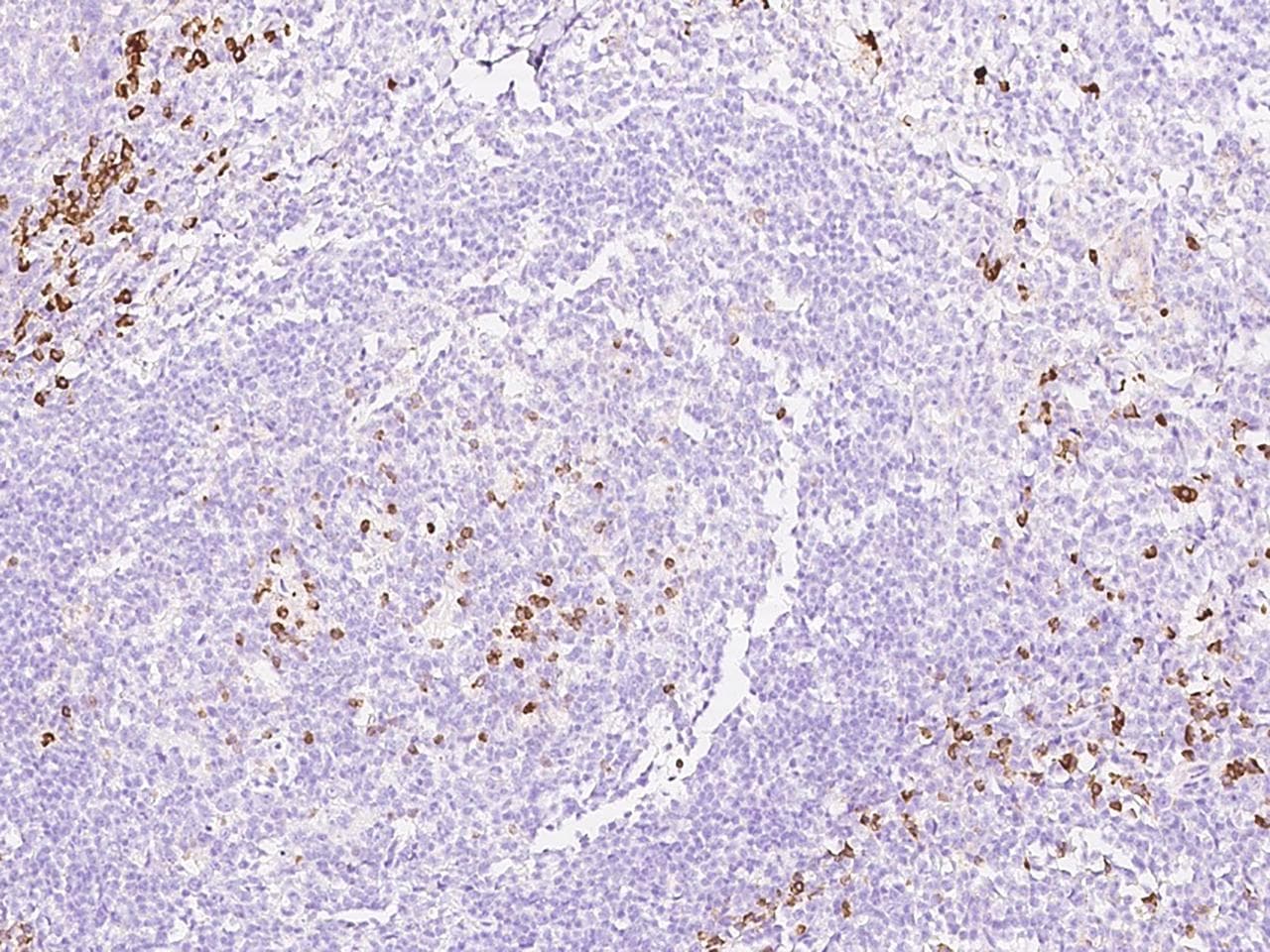 SEC11C Antibody