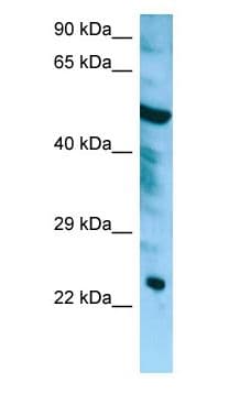 Polyclonal Rabbit anti-Human CHMP6 Antibody (aa100-149, WB)