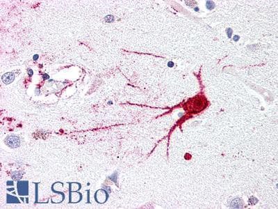 PathPlus™ LGR6 Antibody (N-terminal extracellular domain)