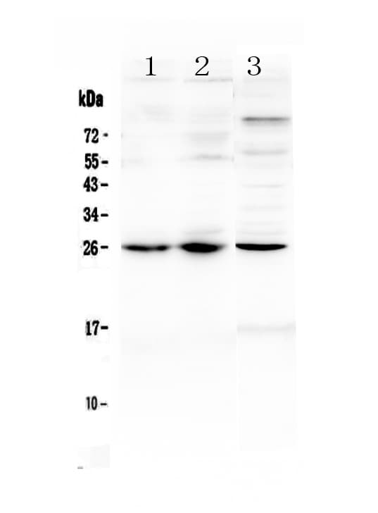 Polyclonal Rabbit anti-Mouse TREM1 Antibody (WB)