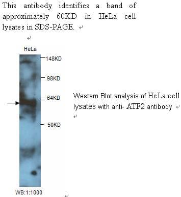 Polyclonal Rabbit anti-Human GDNF Antibody (WB)