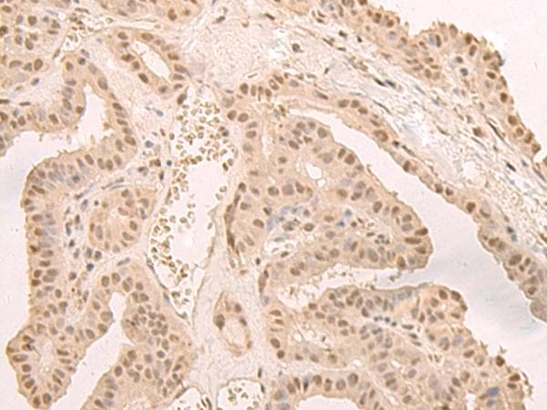 CNOT10 Antibody