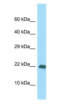 Polyclonal Rabbit anti-Human RPS10 / Ribosomal Protein S10 Antibody (C-Terminus, WB)