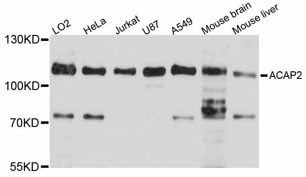 Polyclonal Rabbit anti-Human ACAP2 / Centaurin Beta 2 Antibody (IHC, WB)