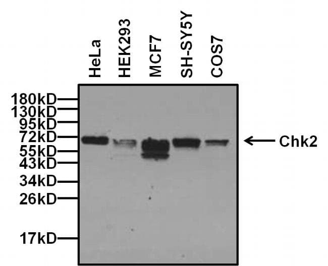 Monoclonal Mouse anti-Human CHEK2 / CHK2 Antibody (clone 1C12B8, IHC, WB)