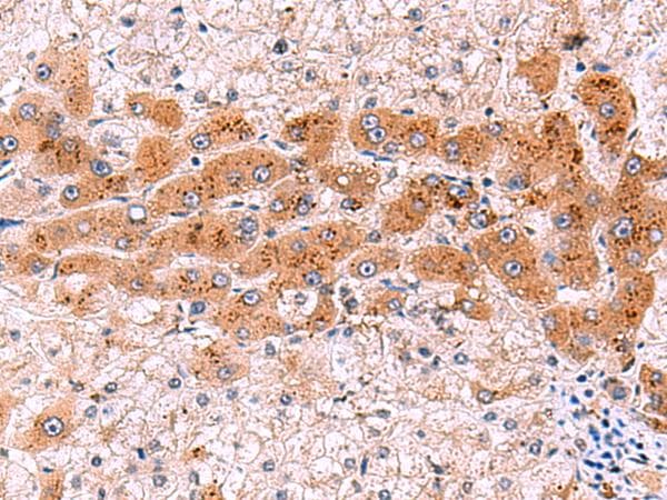 NCAN / Neurocan Antibody