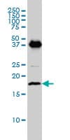Monoclonal Mouse anti-Human EMP3 Antibody (clone 3D4, IHC, WB)