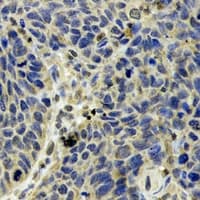 OXCT1 Antibody