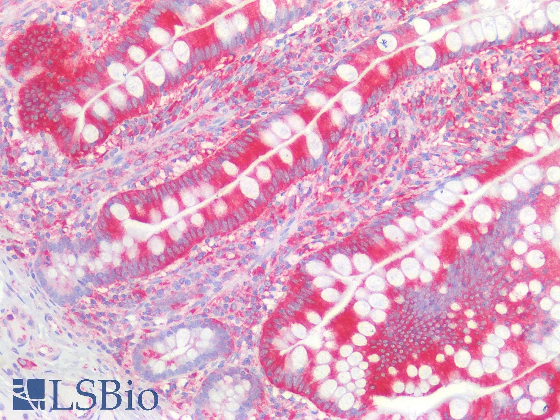 PathPlus™ MVP / VAULT1 Antibody (aa158-380)
