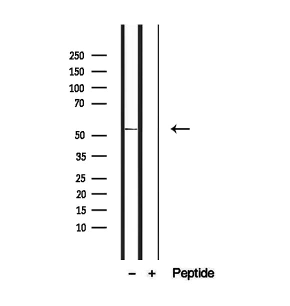 PDIA6 / ERP5 Antibody