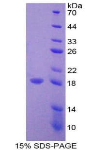 Mouse IL31 Protein (Recombinant His-T7)